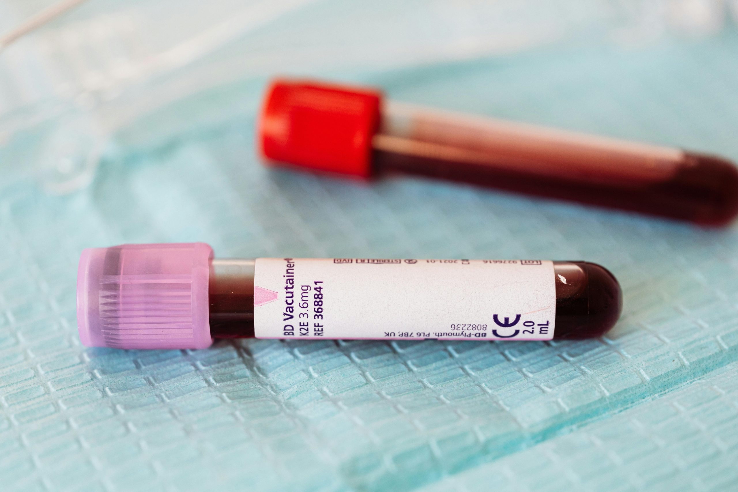 Updated Guidance on QA Oversight of Laboratories Published